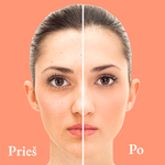 Įkelti vaizdą į galerijos rodinį, ECLALUX™ : LED šviesos terapijos kaukė
