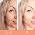 Įkelti vaizdą į galerijos rodinį, ECLALUX™ : LED šviesos terapijos kaukė
