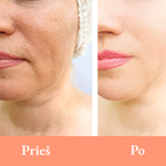 Įkelti vaizdą į galerijos rodinį, ECLALUX™ : LED šviesos terapijos kaukė
